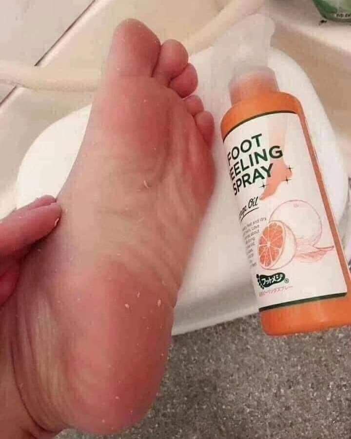 Korean Foot Peeling Spray - Instant Foot Peeling Spray | Silky Smoothness and Lightening from the First Use! 🇰🇷