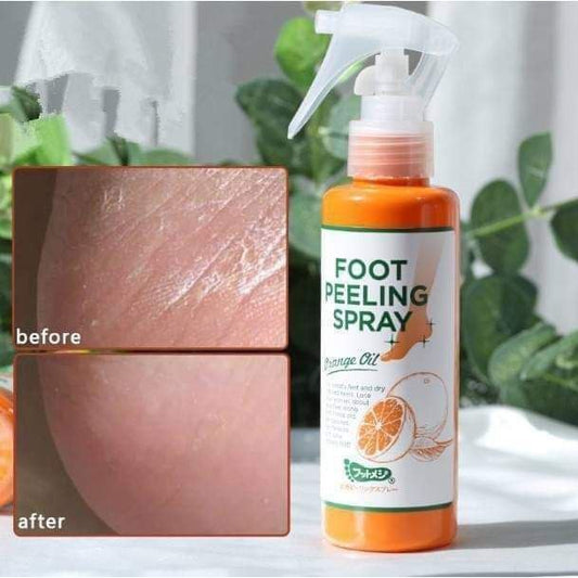 Foot Peeling Spray الكوري – اسبراي تقشير القدم الفوري | نعومة حرير وتفتيح من أول استخدام! 🇰🇷