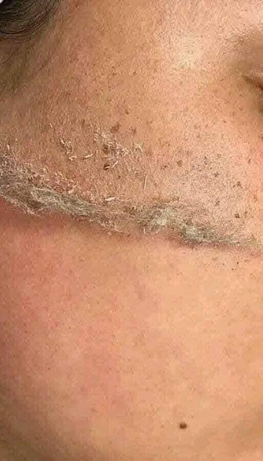 شفرات إزالة الشعر للوجه من ترينا للنساء دي ديرما بلانينج TRINA الأصلية – لبشرة ناعمة وصافية في دقائق - عبوة من قطعتين