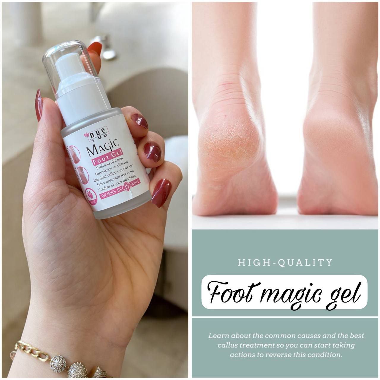 Magic Foot Gel – by Pure Beauty Secret 